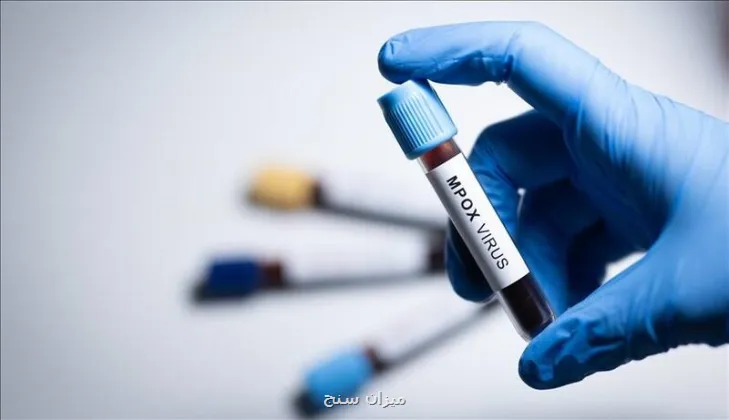 شناسایی سویه جدید ام پاکس در انگلیس